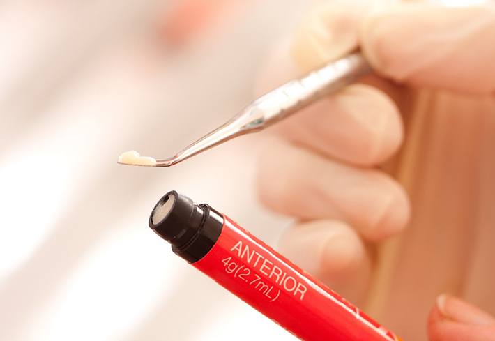 A dentist handling composite dental resin