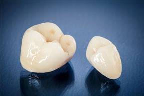 Dental crowns