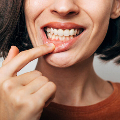 a closeup of a woman with inflamed gums