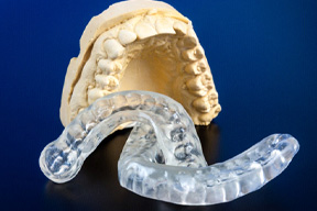 A customized nightguard and mouth mold