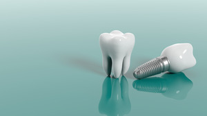 Illustration of dental implant lying next to a tooth